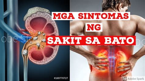 Mga Sintomas ng Sakit sa Bato .